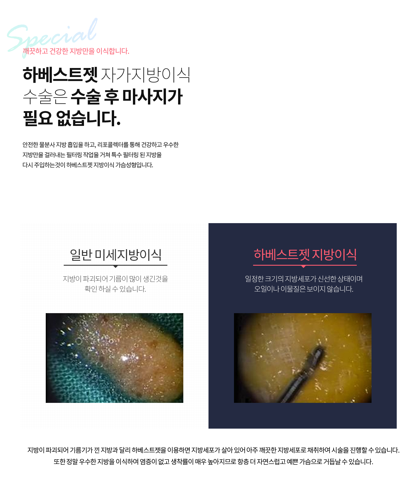 수술 후 마사지가 필요 없습니다.