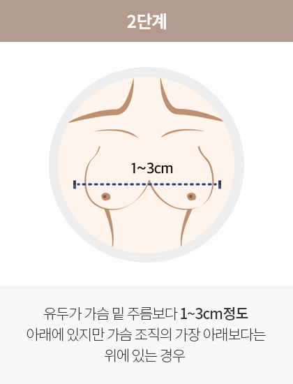 2단계