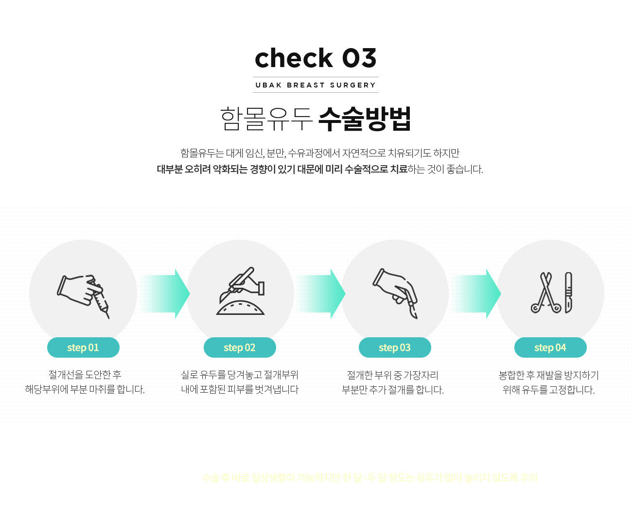 함몰유두성형 수술방법