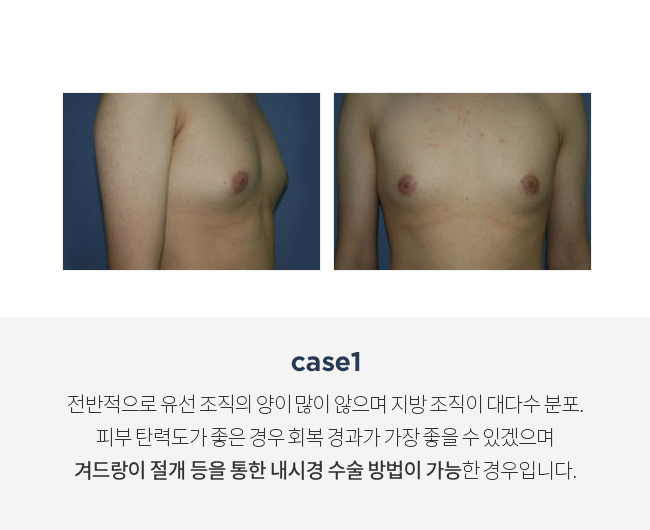 4스페셜