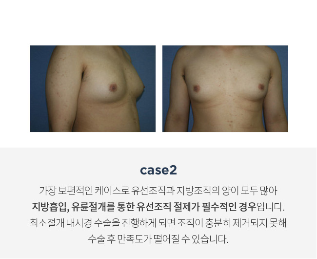 4스페셜