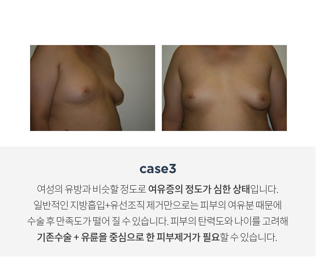 4스페셜