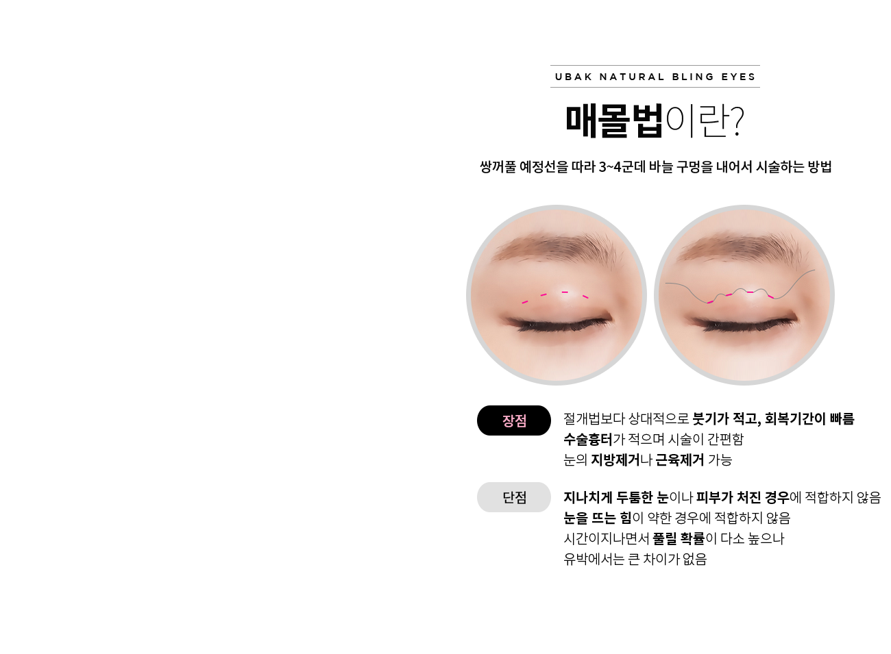 매몰법