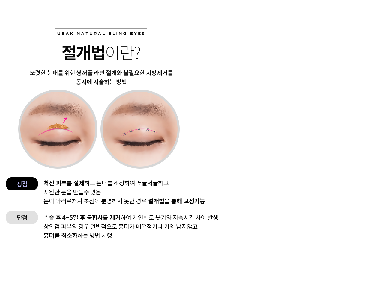 절개법