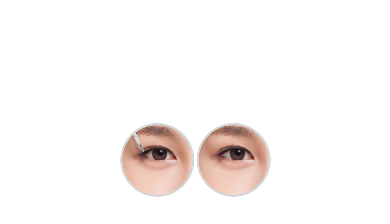 뒤트임