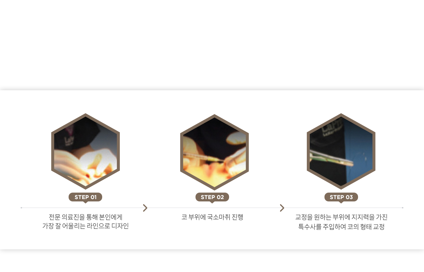 코앤코 시술방법