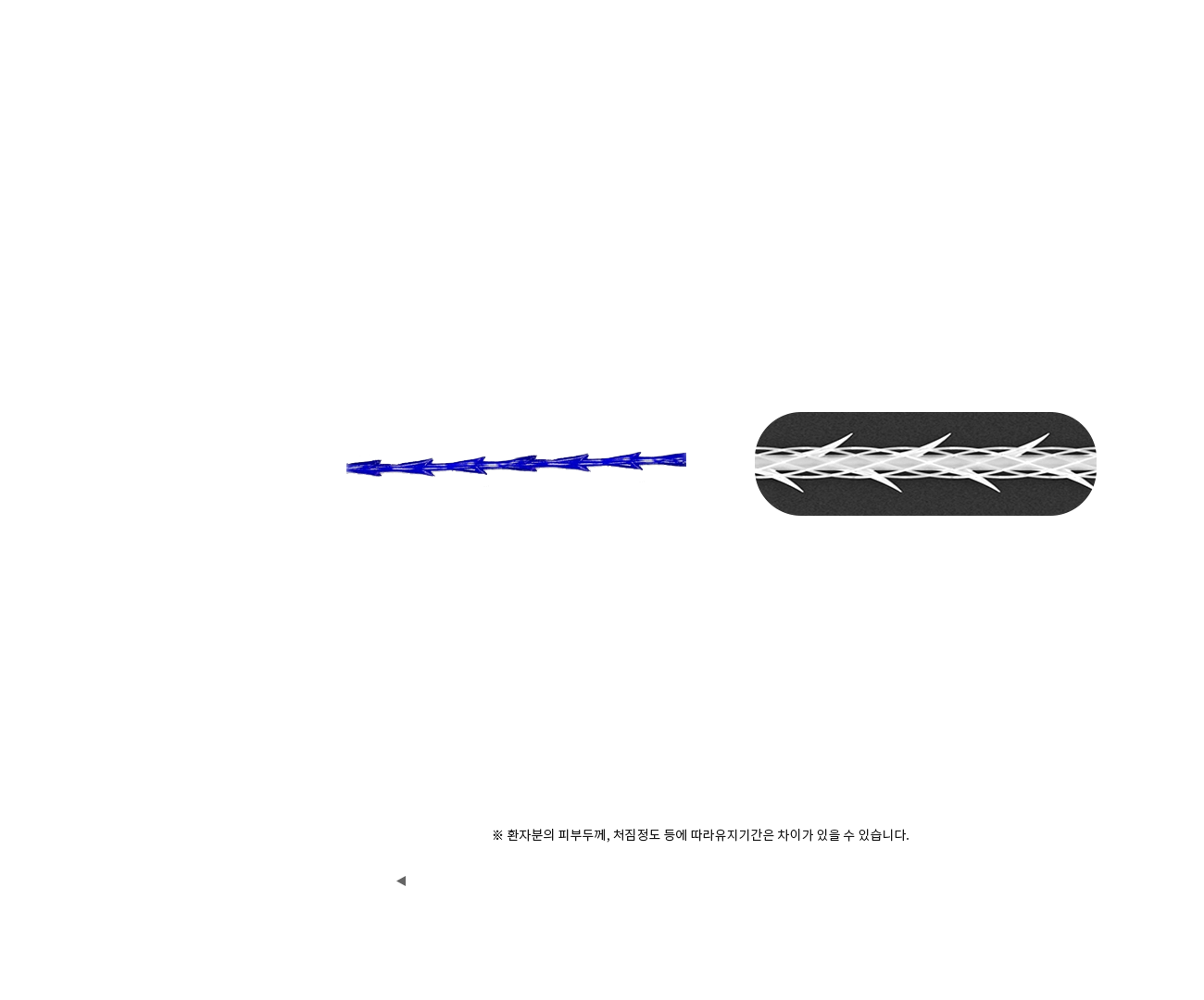 실리프팅 종류