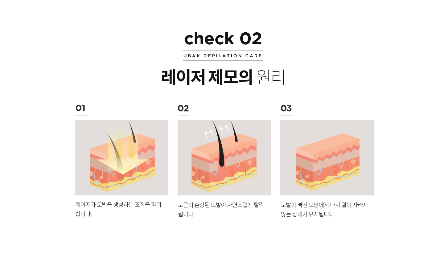 레이저 제모의 원리