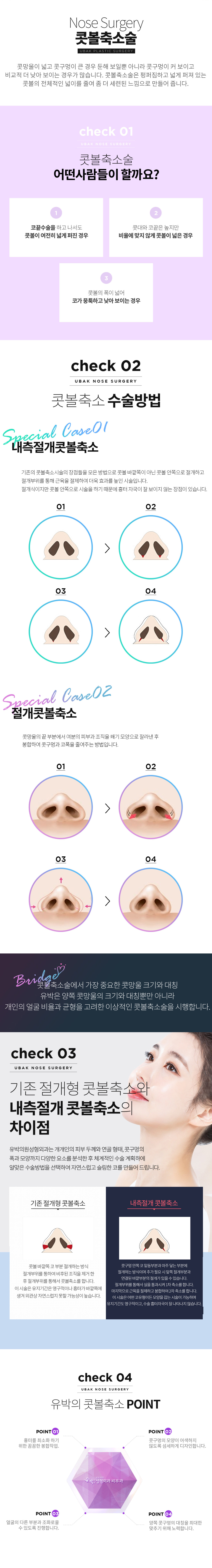 콧볼축소수술